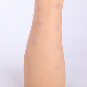 Intradermal injection Model: A 